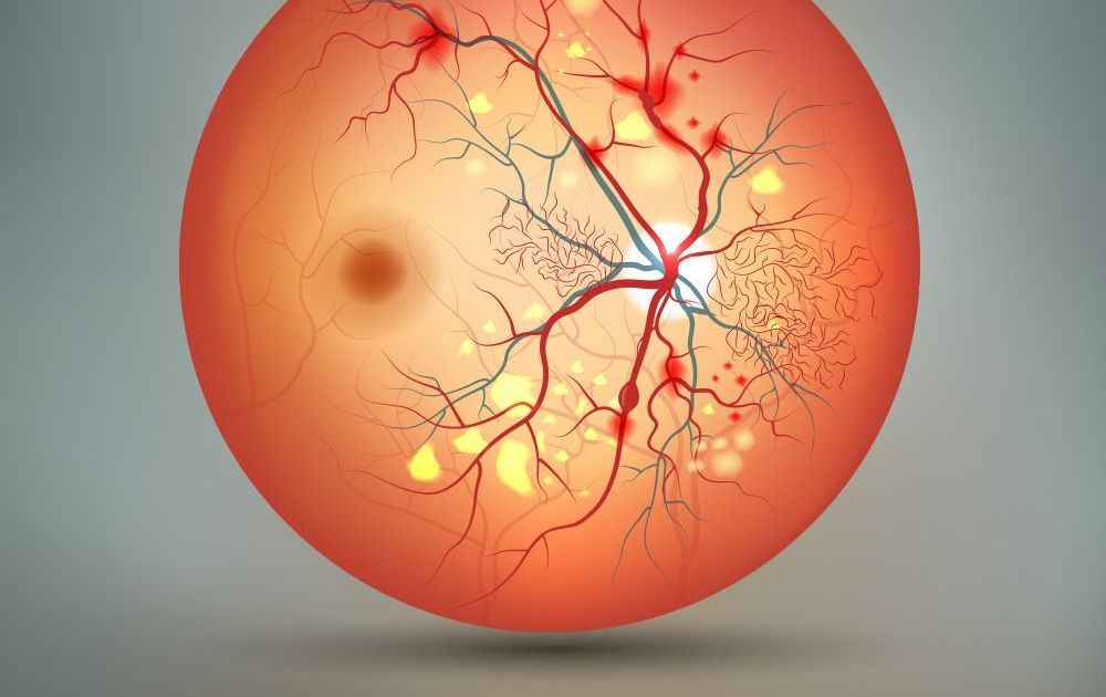 Retinal Imaging Can Predict Changes in Blood Flow